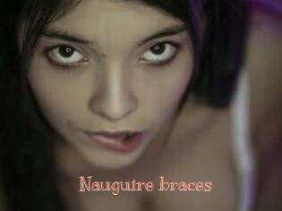 Nauguire_braces
