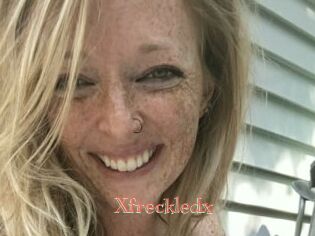 Xfreckledx